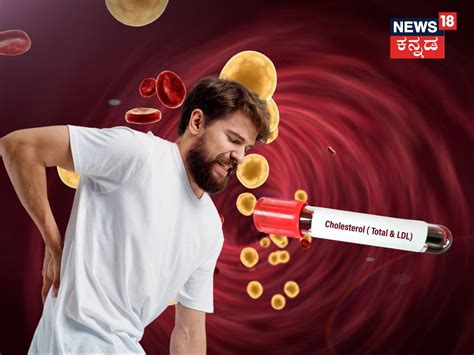 Cholesterol: ದೇಹದ ಈ 3 ಜಾಗಗಳಲ್ಲಿ ನೋವು ಬರ್ತಿದ್ಯಾ? ಹುಷಾರ್‌ ಇದಕ್ಕೆ ಬ್ಯಾಡ್ ...