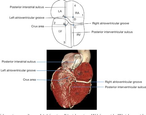 Structure of posterior interventricular sulcus | Semantic Scholar