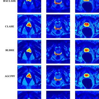 Image result for Map with Net Use
