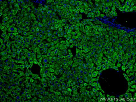 CYP3A4 antibody (67110-1-Ig) | Proteintech