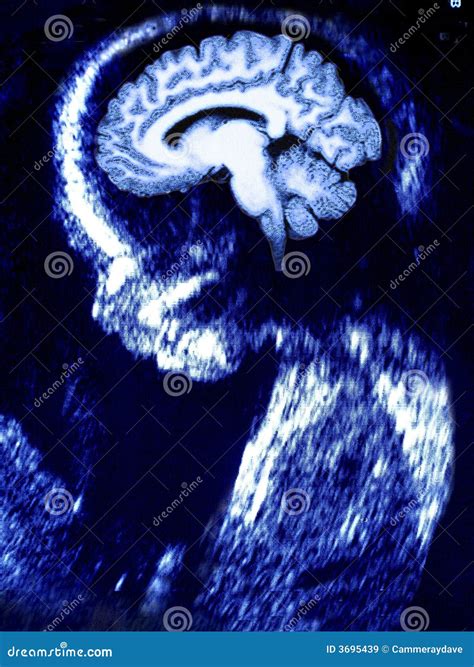 Image result for Human Brain Scan