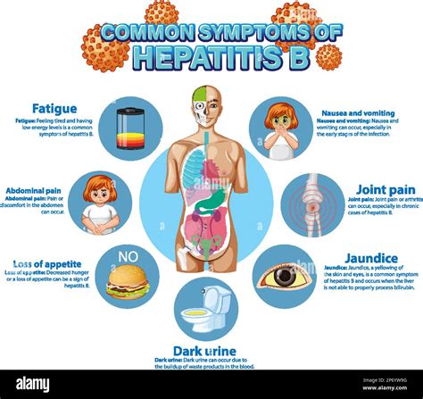 Informative poster of common symptoms Hepatitis B illustration Stock Vector Image & Art - Alamy
