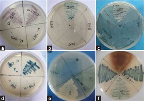 Risk factors and antibiogram of human uropathogens in the northern part ...