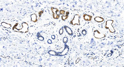 Cytokeratin 18 antibody (82817-5-PBS) | Proteintech
