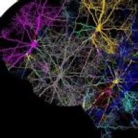 Imaging Brain Connections Can Predict Improvements In Obsessive ...