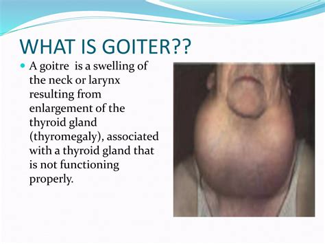 Image result for Thyroid Function Algorithm