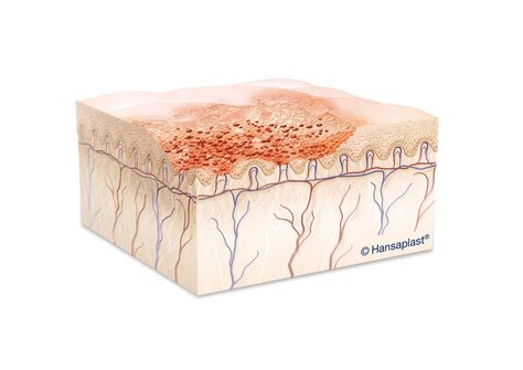 Abrasion Wound Treatment | Instant Help | Elastoplast SA