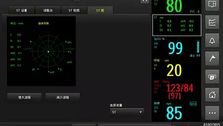 Philips - Efficia CM120 Patient Monitor