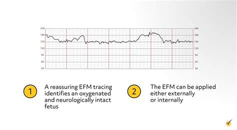 Image result for Absent Variability