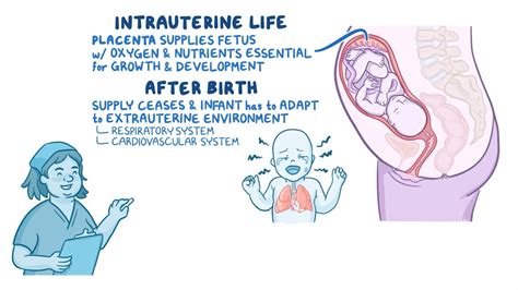 Video: Newborn adaptation to extrauterine life: Nursing | Osmosis