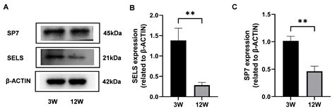 Low Expression of Selenoprotein S Modulates Osteogenic Differentiation ...