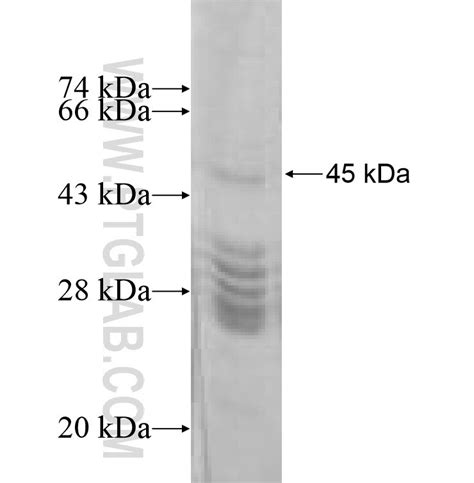 DPYD Fusion Protein Ag8866 | Proteintech