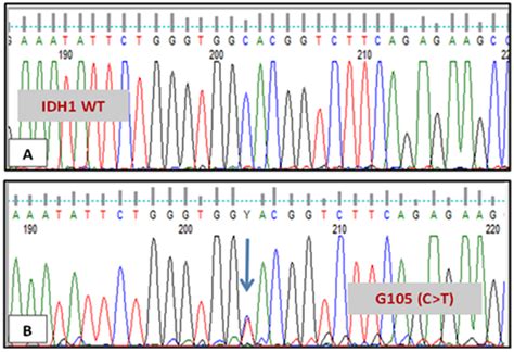 Investigation of Isocitrate Dehydrogenase 1 and 2 Mutations in Acute ...