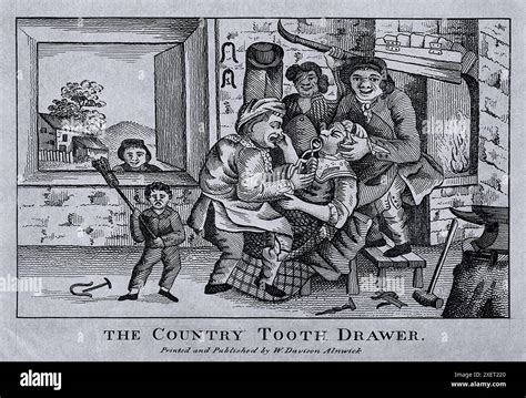 Image result for Medieval Tooth Extraction