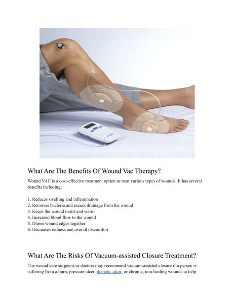 PPT - Everything You Need To Know About Wound Vac (Negative Pressure Wound Therapy) PowerPoint ...