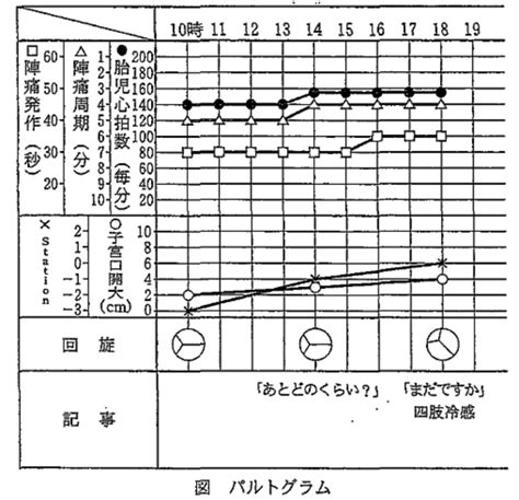 Image result for Computer Support Icon