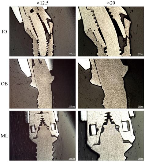 Load-Bearing Capacity and Retention of Newly Developed Micro-Locking ...