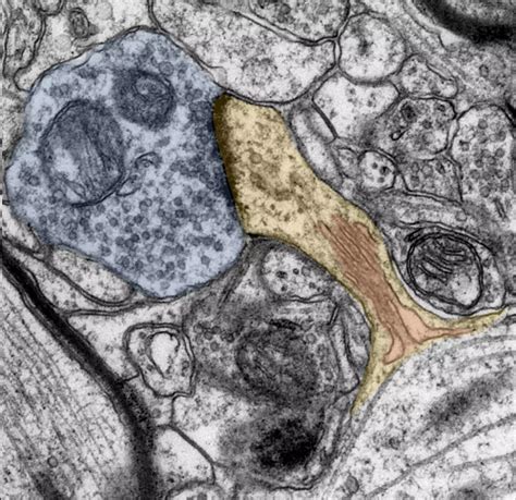 Vitamin A derivative may facilitate neuronal transmission and learning ...