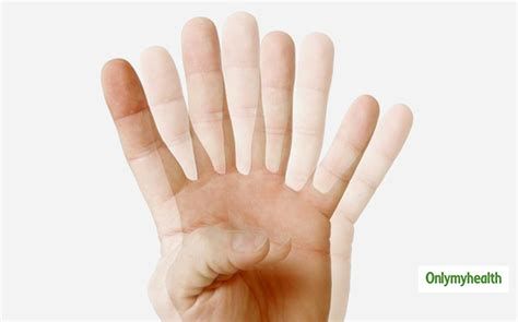 Why Endoscopic Surgery is The Best Treatment for Brain Tumour ...