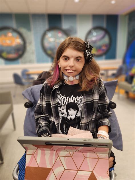 Life Since Harlie: Right TMJ Replacement Surgery