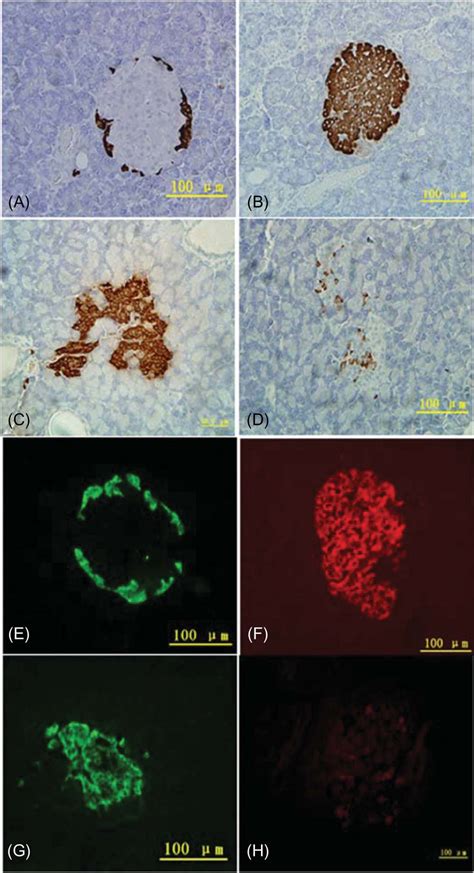Image result for Beta Cell Structure