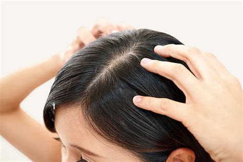 Beauty Benefits Of Apple Cider Vinegar | Femina.in