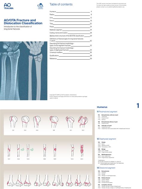 Image result for Fracture Classification System