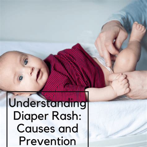 Diaper Rash Treatment: Expert Tips for Happy Babies | Clinikally