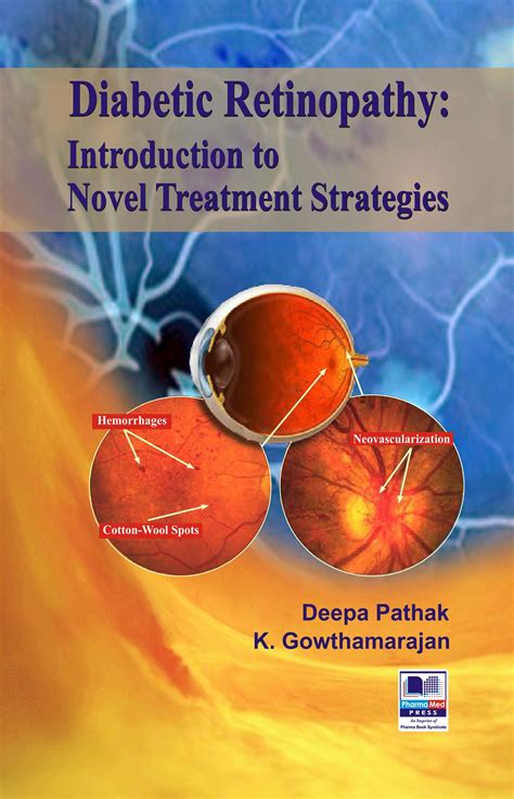 Buy ic Retinopathy: Introduction to Novel Strategies Online at ...