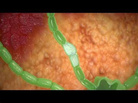 Image result for How to Install Program On Tactile Flexitouch Plus