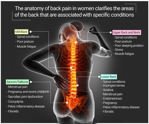 Understanding Female Back Pain: Causes and Symptoms Chart