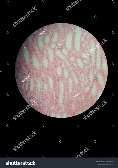 Simple Cuboidal Epithelium Under Microscope