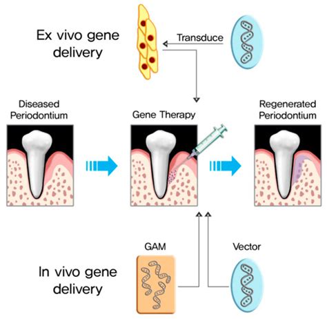 BMP-2 Gene Delivery-Based Bone Regeneration in Dentistry
