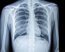 Image result for x-ray