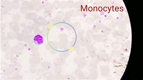 Image result for Monocyte Under Microscope