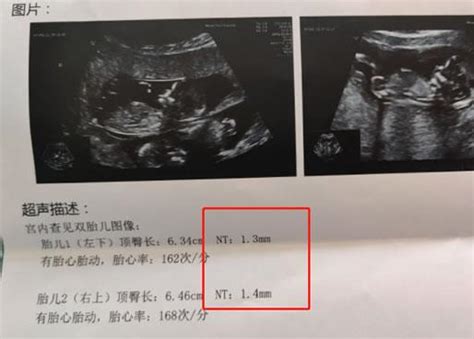 怀孕21-30周图解_科普图库_亲子图库_太平洋亲子网