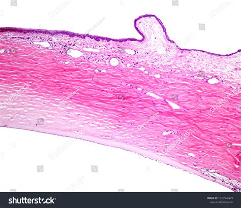 Stratified Squamous Nonkeratinized Epithelium