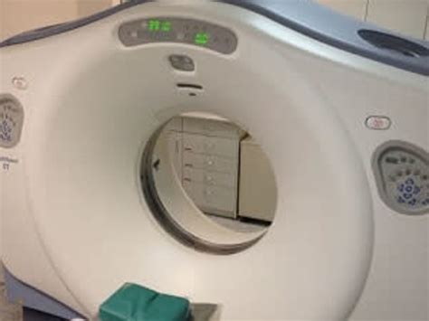 Image result for Colonic Diverticulum CT