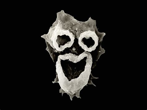 What We Do—and Don't—Know About Brain-Eating Amoebas | National Geographic