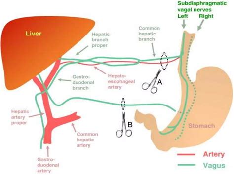 Hepatobiliary anatomy | PPTX