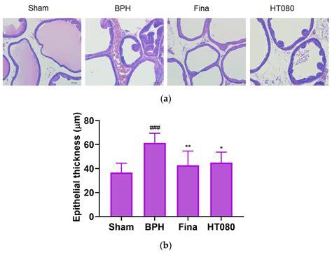 Cinnamomum cassia and Rosa laevigata Mixture Improves Benign Prostatic ...