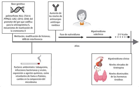 Que Es Una Enfermedad Autoinmune De Tiroides - Infoupdate.org