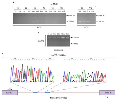 Gene-Specific Intron Retention Serves as Molecular Signature that ...