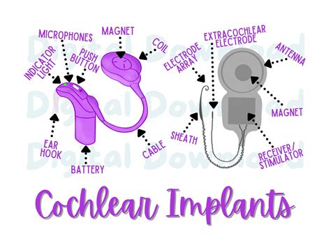 Image result for Cochlear