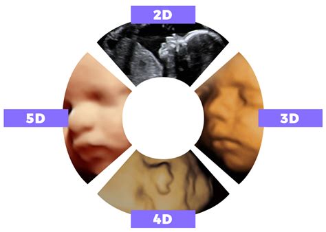What is 4D and difference between 3D and 4D? - Irsh Tech Blog