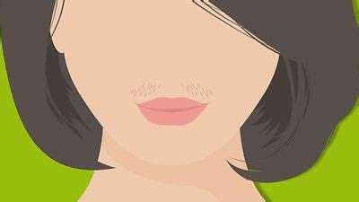 Understanding The PCOS Hirsutism Dynamic andMe