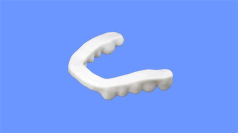 Understanding Nylon Splints: Advantages, Applications, And Limitations | Avant Dental