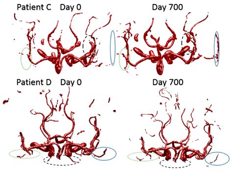 A Novel MRA-Based Framework for Segmenting the Cerebrovascular System ...