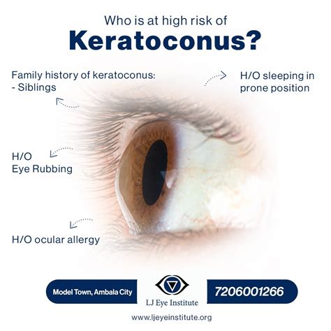 Keratoconus: Symptoms, Causes & Treatment - LJ Eye Institute