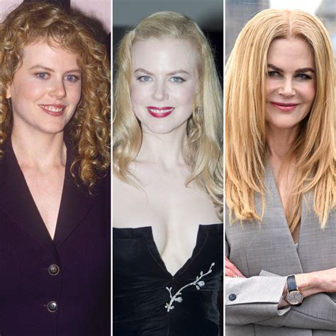 Nicole Kidman Antes E Depois Da Plastica No Nariz